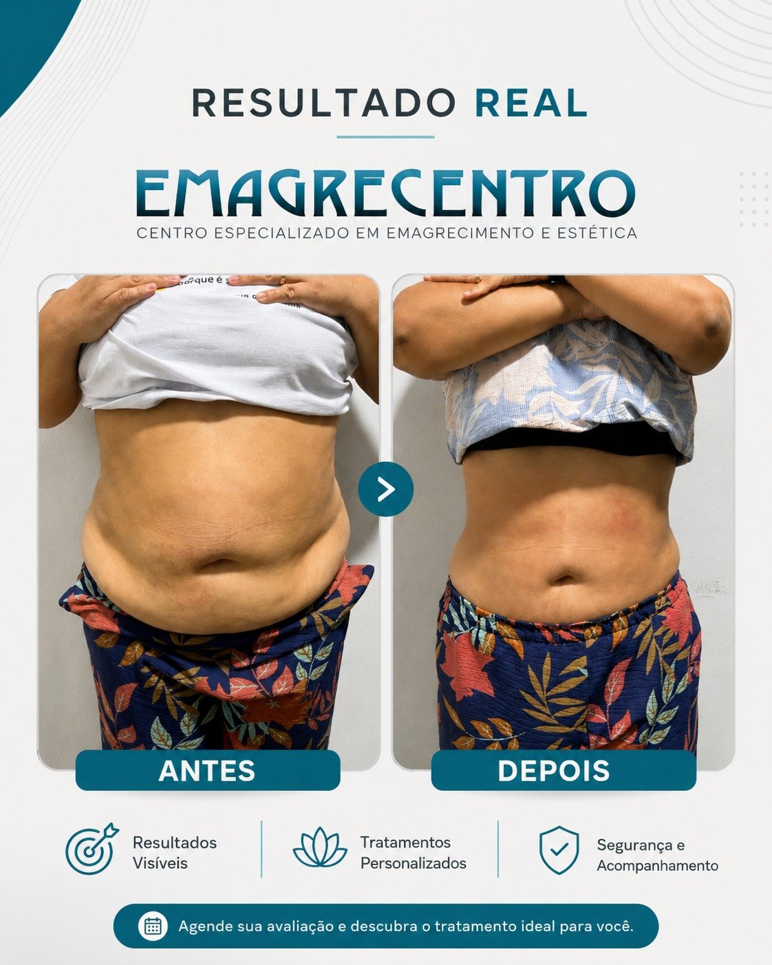 Resultado real Emagrecentro 1